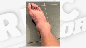 les images terribles de la cheville de Cazaux, contraint à l’abandon à un mois de Roland-Garros