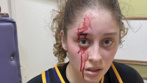 Basket : la fille de cette légende du tennis termine son match avec 40 points… et le visage en sang