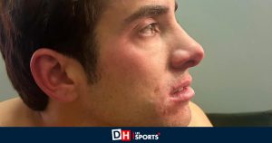 Affaire Zizou Bergs–Cristian Garin en Coupe Davis : Et si le Chilien avait simulé, comme un footballeur… (COMMENTAIRE)